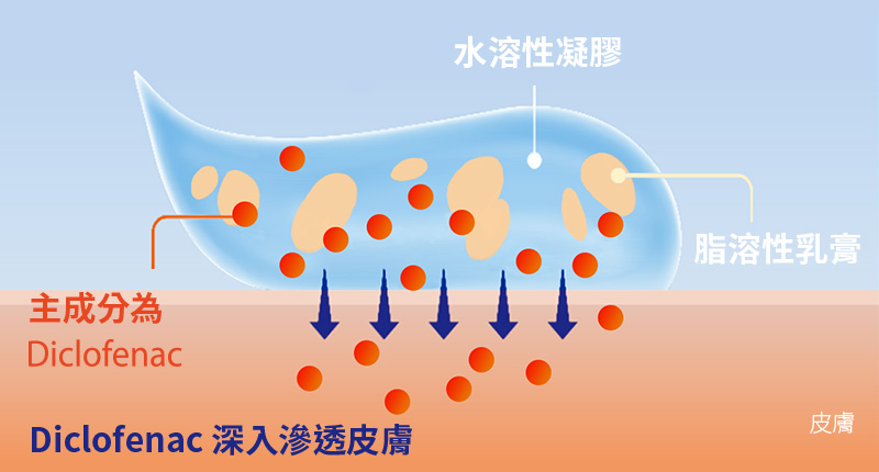 Diclofenac 深入滲透皮膚達一公分，直達疼痛根源